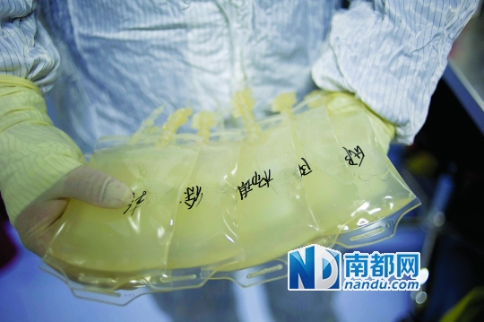 <p>    經過培養的細胞液最終要回輸到患者體內。</p>